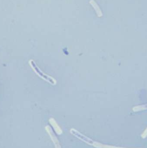 Capsule stain showing clear halos around purple rod-shaped bacteria against a light background.