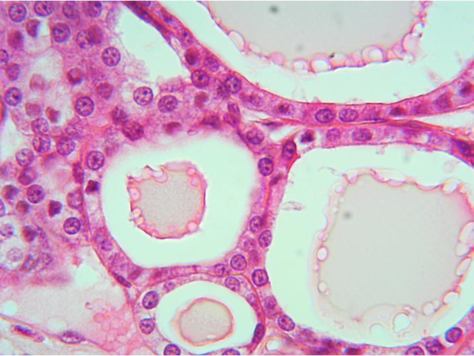 histiology slide image of the thyroid gland at 400X magnification