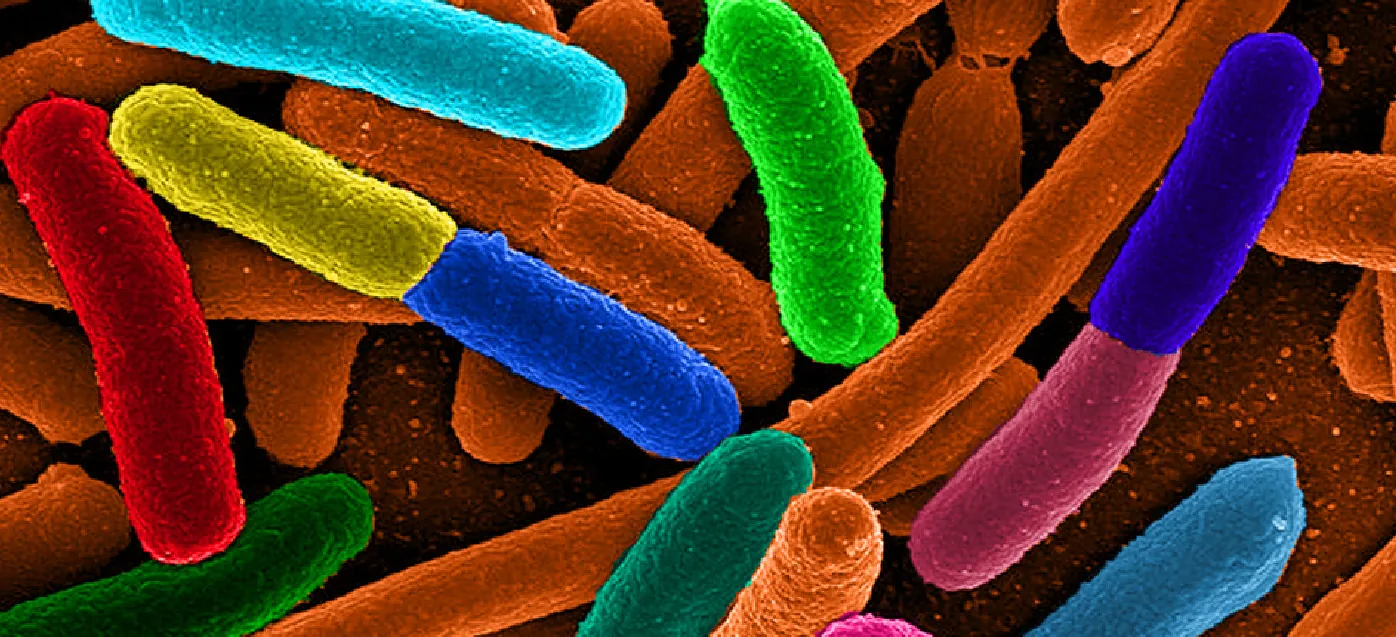 Escherichia coli (e Coli) bacteria.