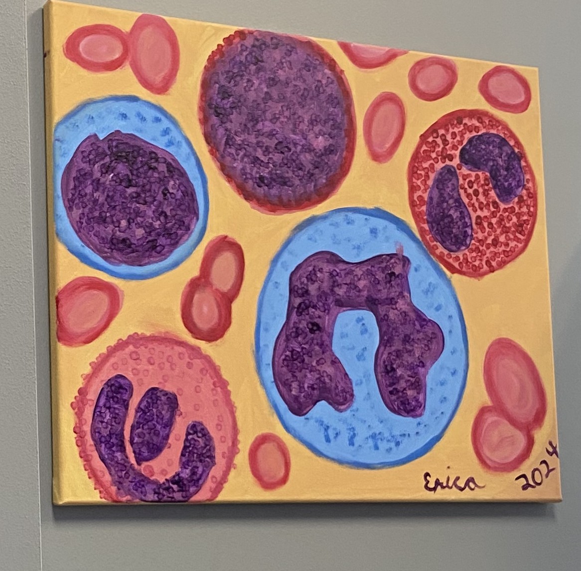 Painted blood smear showing white blood cells with purple nuclei of different shapes among smaller red blood cells.