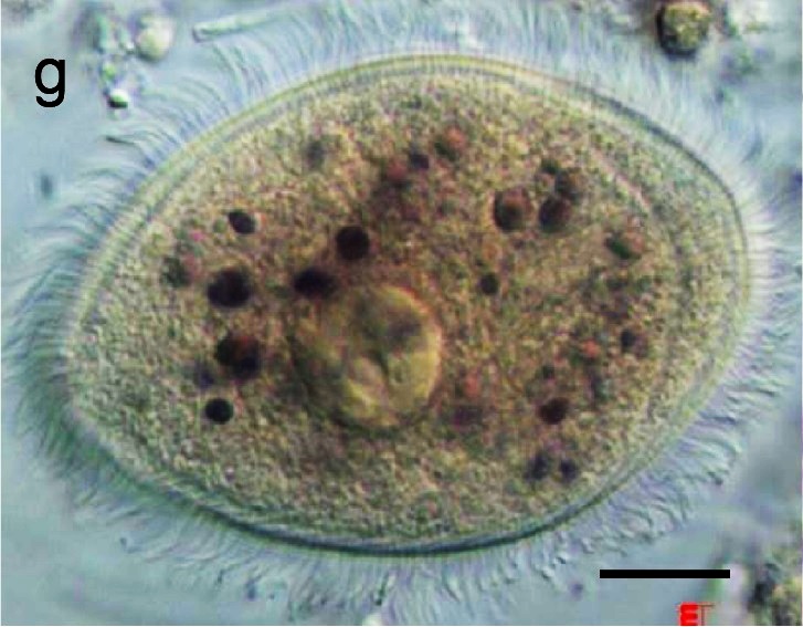 A micrograph of an oval cell with many short projections.